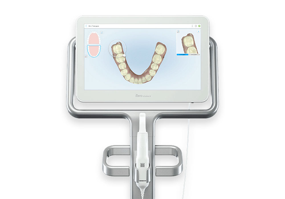 iTero