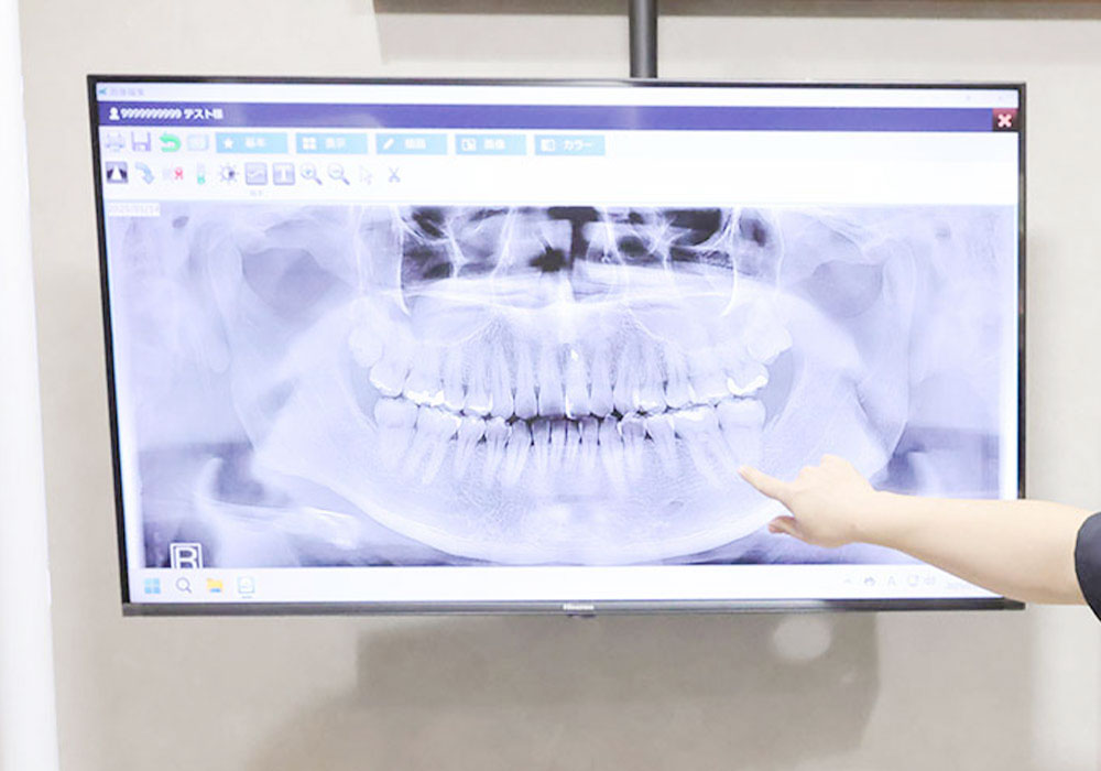 説明用モニター