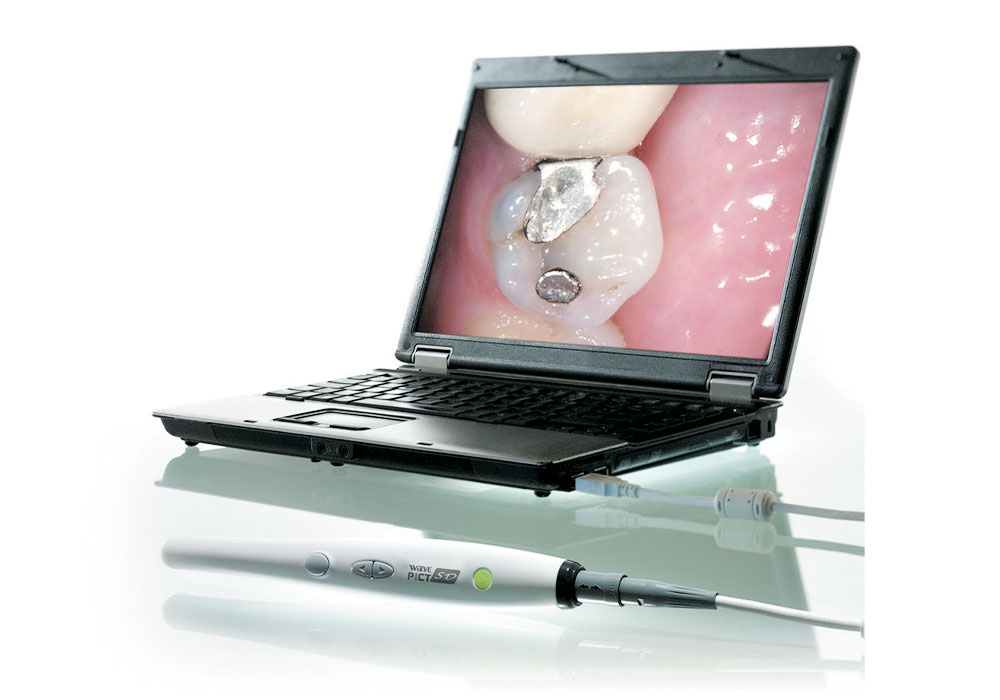 口腔内カメラ(一眼・ペンタイプ)